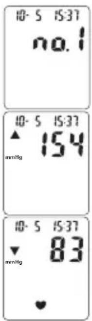 TOPCOM BPM ARM 3301 - Procedure - 1