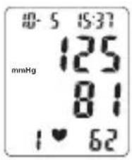 TOPCOM BPM ARM 3301 - Procedure - 2