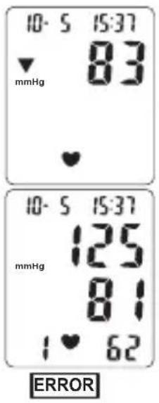 TOPCOM BPM ARM 3301 - Verfahren - 2