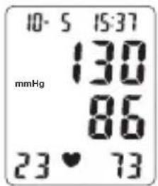 TOPCOM BPM ARM 6331 - Display - 6
