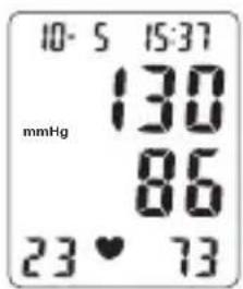 TOPCOM BPM ARM 6331 - Display - 3