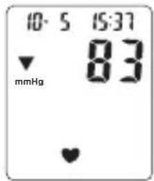 TOPCOM BPM ARM 6331 - Bruke mansjetten - 3