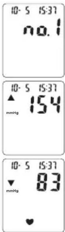 TOPCOM BPM ARM 6331 - Procedure - 1