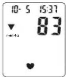 TOPCOM BPM ARM 6331 - Menettely - 3