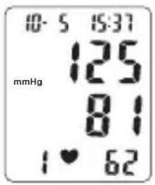 TOPCOM BPM ARM 6331 - Procedure - 2