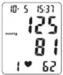 TOPCOM BPM ARM 6331 - Menettely - 4