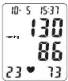 TOPCOM BPM ARM 6331 - Display - 3
