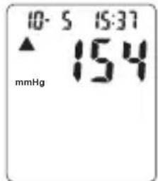 TOPCOM BPM ARM 6331 - Procedure - 2