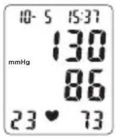 TOPCOM BPM ARM 6331 - Bruke mansjetten - 4