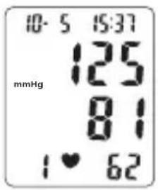 TOPCOM BPM ARM 6331 - Prosedyre - 2