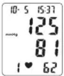 TOPCOM BPM ARM 6331 - Procedure - 2