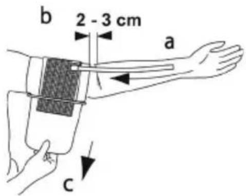 MEDISANA CardioCompact - Verenpainemansetin kiinnittäminen - 1