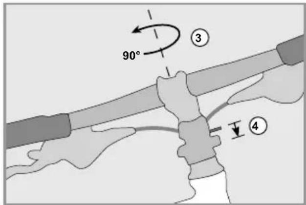 Flyer Gotour 4 - Speedlifter Twist - 6