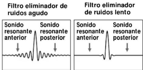 SONY SCD555ES - Eliminador de ruidos agudo y lento - 2
