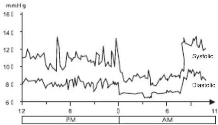 Geratherm Tensio Control GP6220 - Fluctuation and variation in blood pressure - 2
