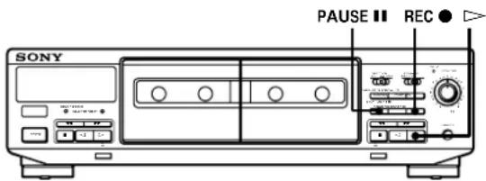 SONY TCWR661 - Réglage automatique du niveau d'enregistrement (fonction d'auto-réglage du son) - 1