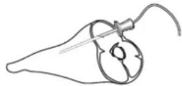 BAUKNECHT ECSK11 F845 - DE VOEDSELSONDE GEBRUIKEN - 2