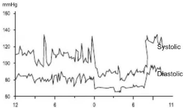 Geratherm Desktop GP6621 - Fluctuation and variation in blood pressure - 1