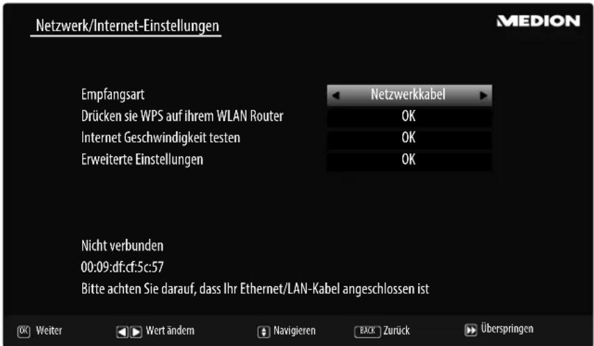 MEDION LIFE P14310 (MD 31360) - Netzwerk/Internet-Einstellungen - 1