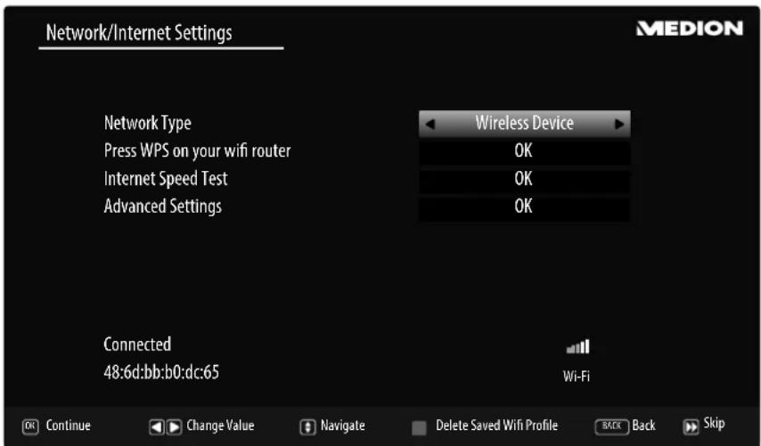 MEDION LIFE P14310 (MD 31360) - Network/Internet settings - 1
