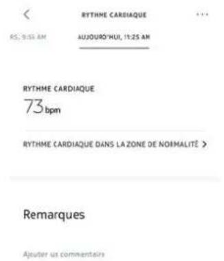 NOKIA BPM+ - Afficher l'histoire de mes mesures - 2
