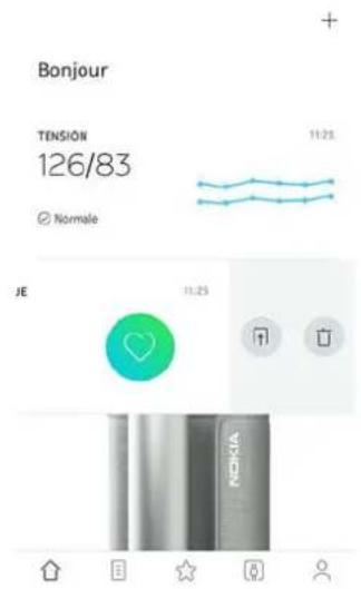 NOKIA BPM+ - Supprimer des données - 1