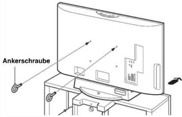 SONY SUFL300M - Bringen Sie die Ankerschrauben an. - 1