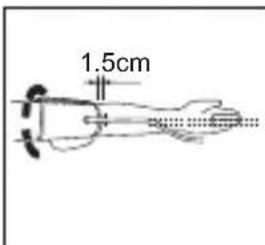 Levita BPM ARM 6331 - Positionner la manchette - 3