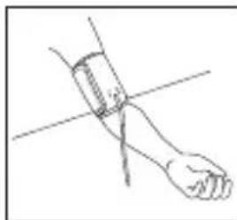 Levita BPM ARM 6331 - Positionner la manchette - 5