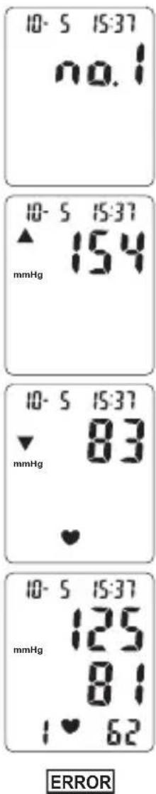Levita BPM ARM 6331 - Verfahren - 1