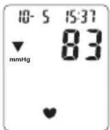 Levita BPM ARM 6331 - Procedure - 3