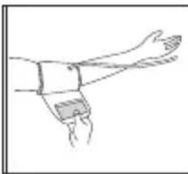 Levita BPM ARM 6331 - De armband aanbrengen - 4
