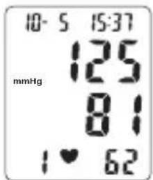 Levita BPM ARM 6331 - Procedure - 4