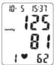 Levita BPM ARM 6331 - Procedure - 4