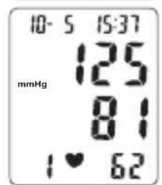 Levita BPM ARM 6331 - Procedure - 4