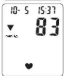 Levita BPM ARM 6331 - Procedure - 3
