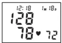TOPCOM BPM ARM 5000 - Procedure - 3