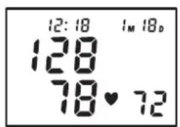 TOPCOM BPM ARM 5000 - Procedure - 3