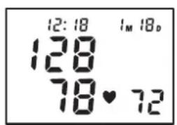 TOPCOM BPM ARM 5000 - Verfahren - 3