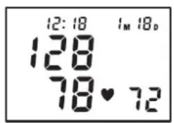 TOPCOM BPM ARM 5000 - Inleiding - 12