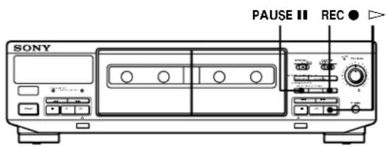SONY TCWE405 - Adjusting the Recording Level Automatically (Auto Rec Level) - 1