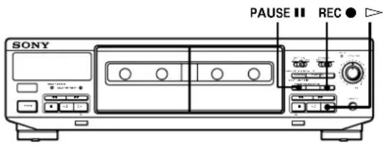 SONY TCWE405 - Réglage automatique du niveau d'enregistrement (fonction d'auto-réglage du son) - 1