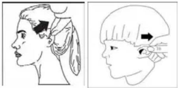 MICROLIFE IR 1DA1 - Instructions d'utilisation - 4