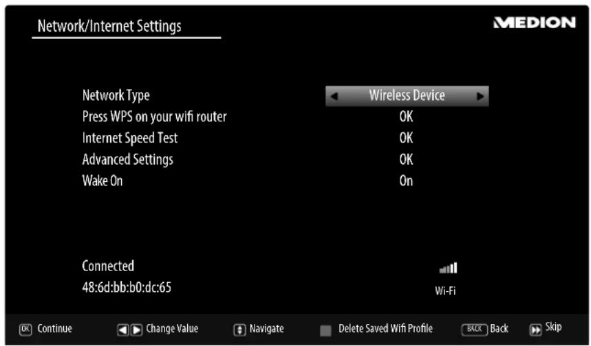 MEDION LIFE P14337 (MD 31337) - Network/Internet settings - 1