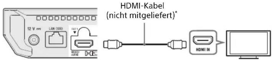 SONY UBPX700B - AnschlieBen an Ihr Fernsehgerät - 1