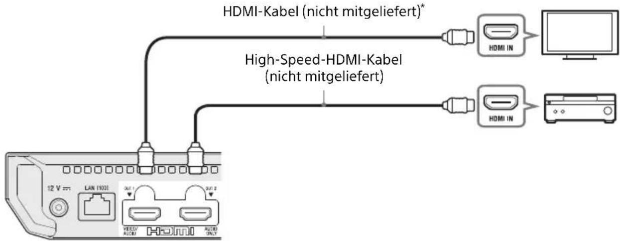 SONY UBPX700B - AnschlieBen an Ihr Fernsehgerat per Soundbar/AV-Versteller (Receiver) - 2