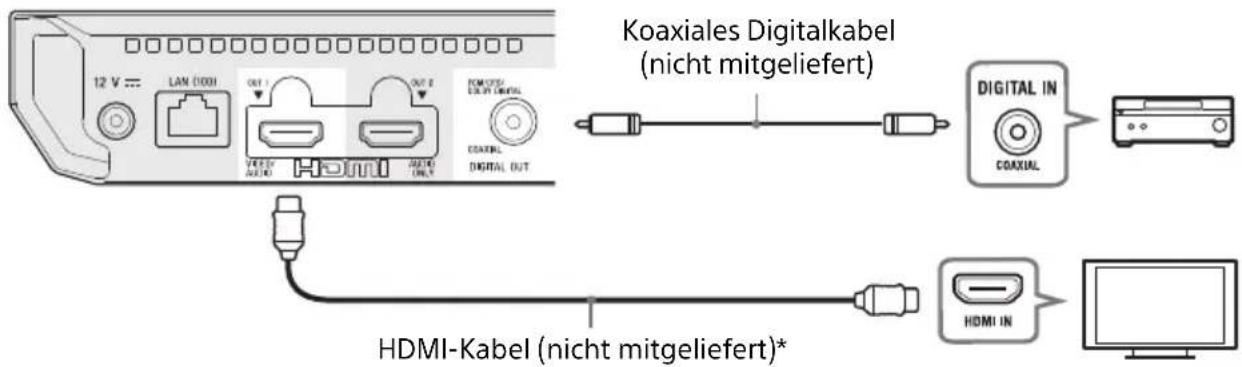 SONY UBPX700B - AnschlieBen an Ihr Fernsehgerat per Soundbar/AV-Versteller (Receiver) - 3