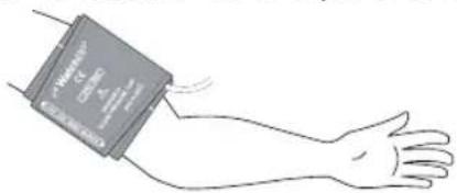 MICROLIFE WatchBP Office AFIB - Mode « SCREEN » - 2