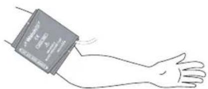 MICROLIFE WatchBP Office ABI - Mode « ROUTINE » - 2