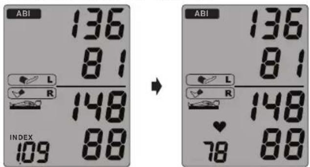 MICROLIFE WatchBP Office ABI - Mesure de la pression arterielle avec le WatchBP Office (suite) - 3